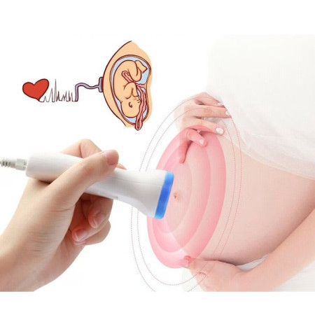 Monitor Fetal Doppler, Cyrax, Monitorizare Sarcina, Ritm Cardiac, Ecran LCD 4.5 cm, 2 x Baterii AA (neincluse), Portabil, din ABS, 12.8 x 9.6 x 3 cm, Utilizare de la 9 Saptamani, Albastru